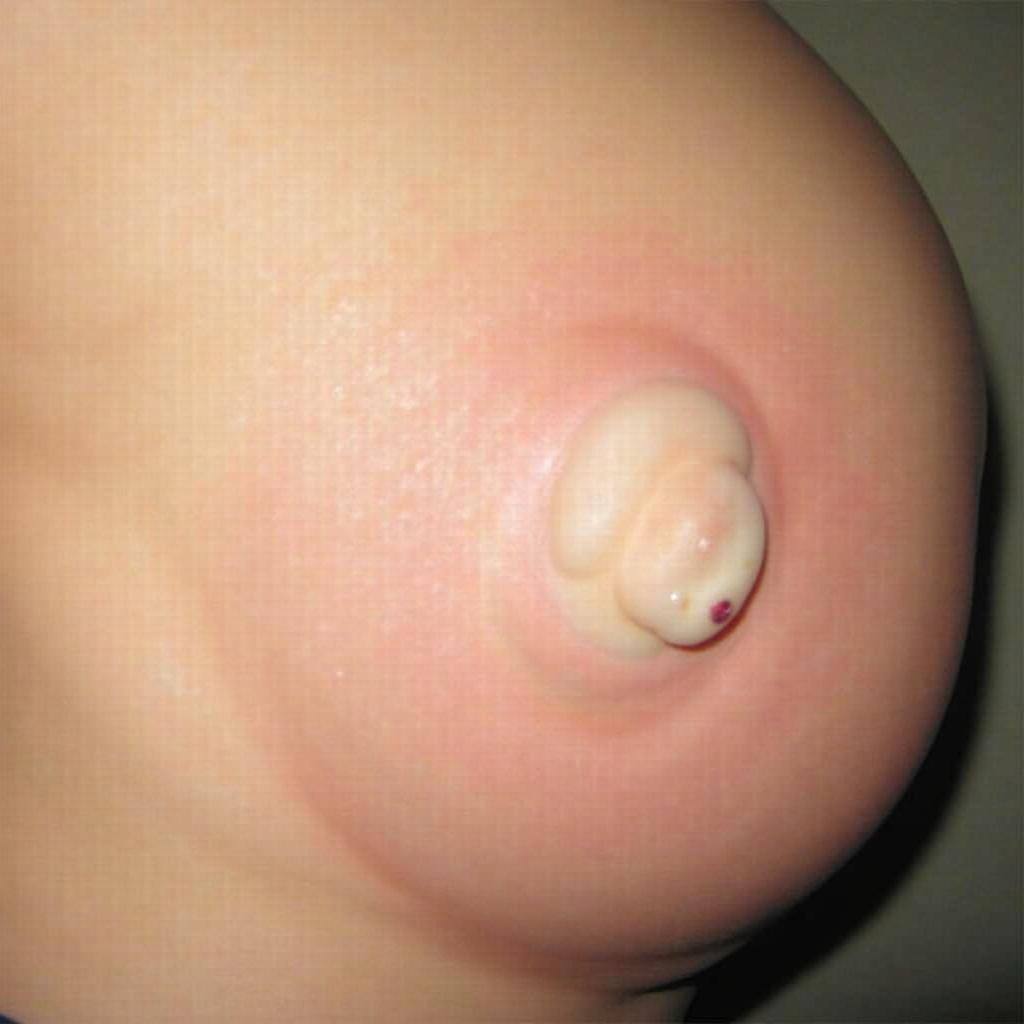 Anh chup quang vu co cac hat dau noi len khi moi mang thai